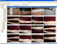 MedicalPhoto screenshot